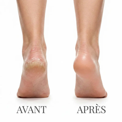 VelvetFeet Pro™